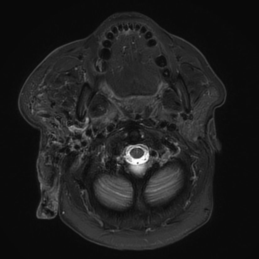 Soft Tissue Of The Neck Philips MR Body Map