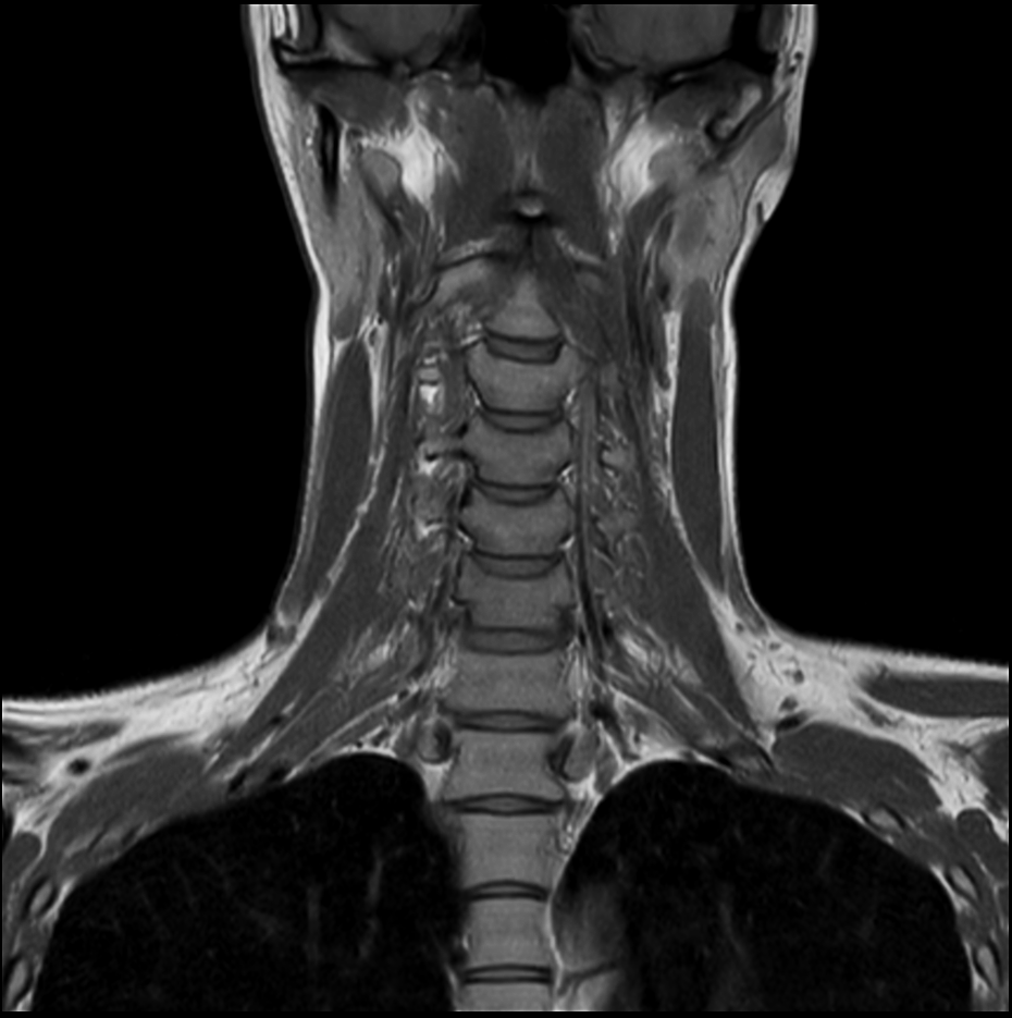 Posterior Triangle Philips MR Body Map